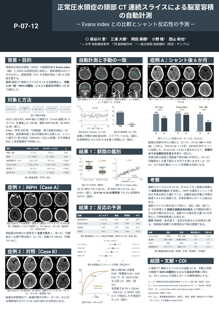 正常圧水頭症の脳室容積計測の臨床研究ポスター作例(図43点)