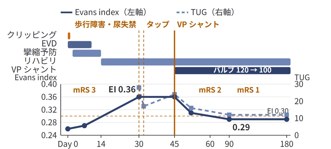 VPシャント前後の臨床経過図(処置の帯と評価の推移)