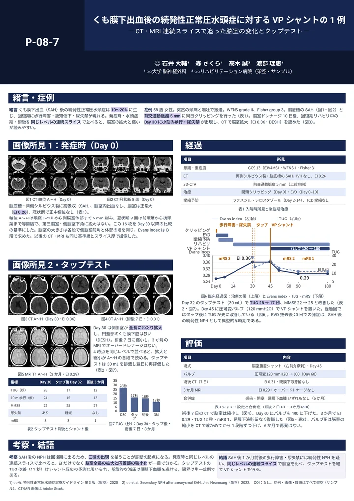 脳神経外科・症例報告のポスター作例(CT・MRI 40コマ+グラフ・表 5点(計45点))