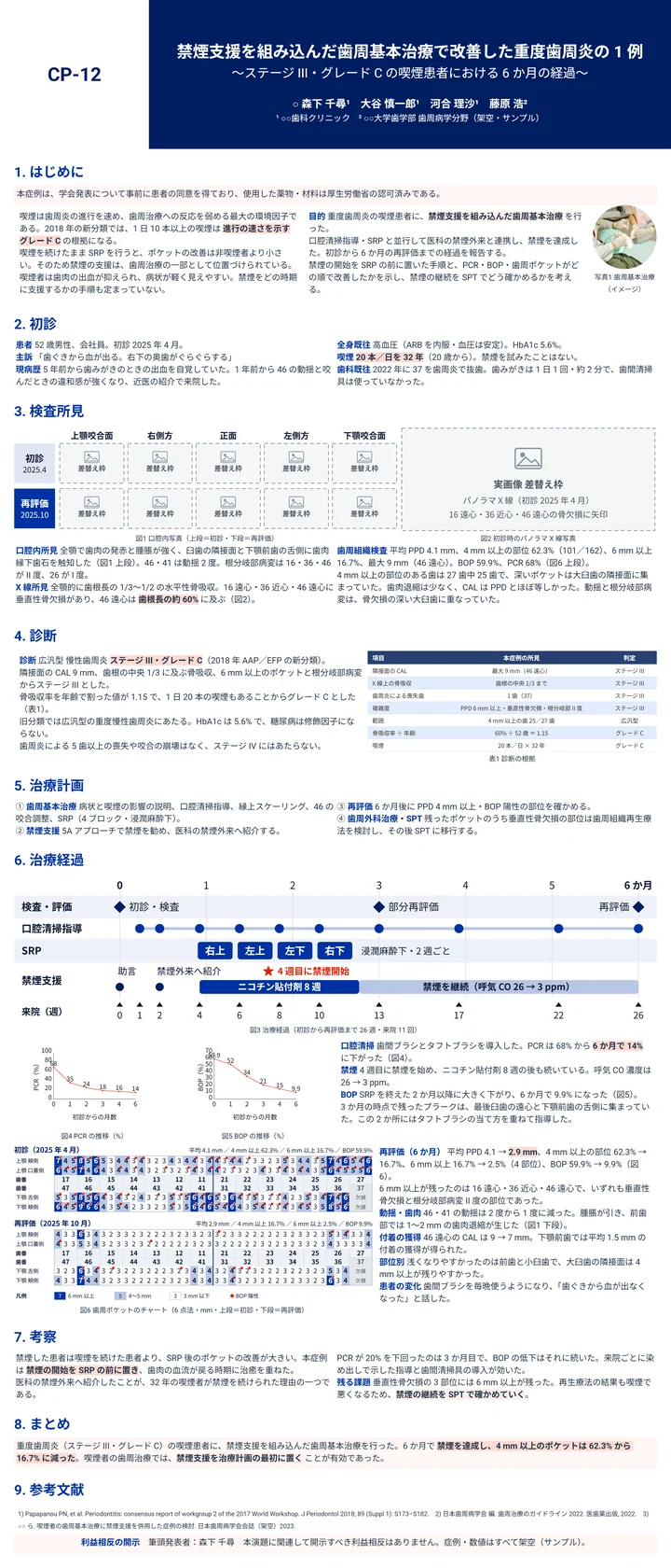禁煙支援を組み込んだ歯周基本治療の症例報告ポスター作例