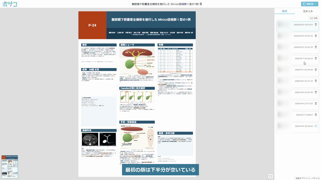 履歴タブに保存した版が日時で並び、選んだ版が中央に表示されている画面