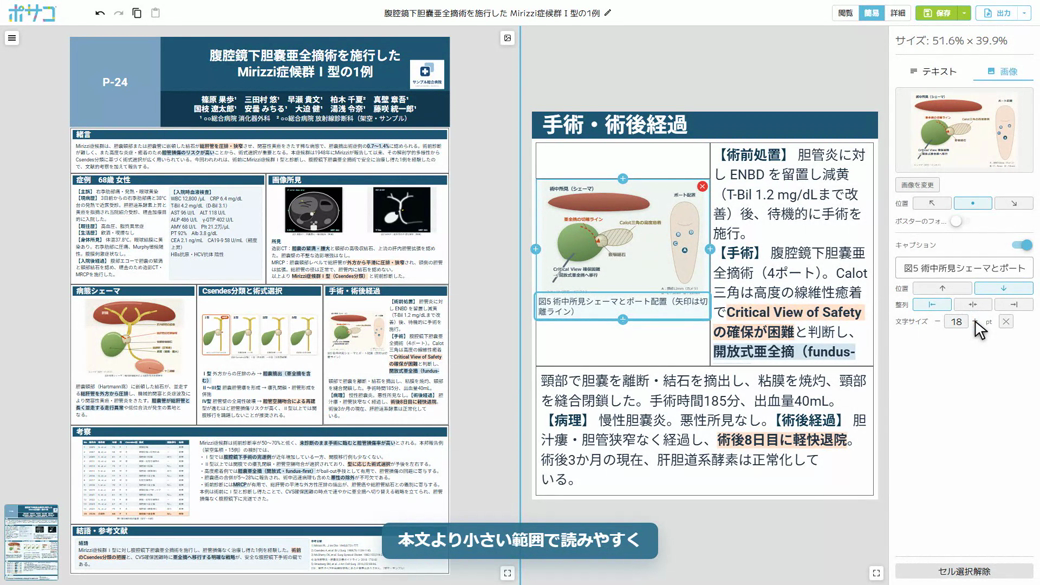 図のセルを選び、右端のパネルでキャプションを書き足して位置・整列・文字サイズを整えた画面
