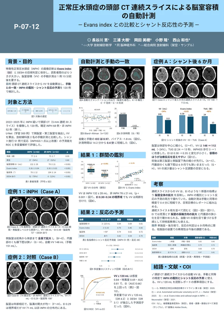 正常圧水頭症の頭部 CT 連続スライスによる脳室容積の自動計測（臨床医学・A0 縦・縦3列の作例）