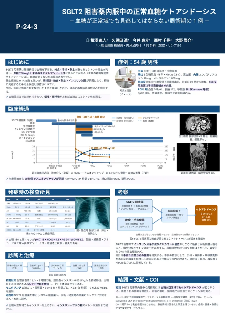 SGLT2 阻害薬内服中の正常血糖ケトアシドーシス（症例報告・A0 縦・Z 型 2－1－2の作例）